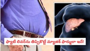 Fatty Liver Tips: ఫ్యాటీ లివర్‌ను రివర్స్ చేసే పవర్ఫుల్ రెమిడీ.. ఆరు నెలల్లో కాలేయం మొత్తం క్లీన్!