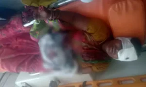 మంచిర్యాలలో చెత్తను కాలుస్తుండగా పేలుడు...  మహిళకు తీవ్ర గాయాలు