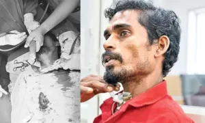 చేపలు పడుతుండగా మత్య్సకారుడి గొంతులో ఇరుక్కున్న చేప
