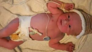 Umbilical Cord: బొడ్డు తాడు పారేస్తున్నారా? ప్రాణాంతక వ్యాధులను నయం చేసే ‘మెడికల్ మిరాకిల్’ ఇదే!