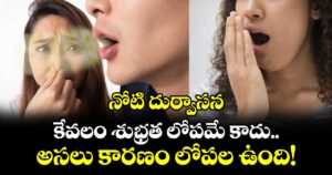 నోటి దుర్వాసన: కేవలం శుభ్రత లోపమే కాదు.. అసలు కారణం లోపల ఉంది!