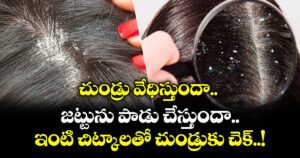 Health Tips : చుండ్రు వేధిస్తుందా.. జట్టును పాడు చేస్తుందా..ఇంటి చిట్కాలతో చుండ్రుకు చెక్..!