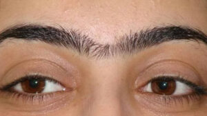 Eyebrow: కనుబొమ్మలు రెండూ కలిస్తే ఏమవుతుందో తెల్సా.. ఇది అస్సలు ఊహించి ఉండరు