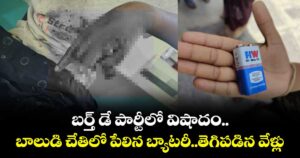 బర్త్ డే పార్టీలో విషాదం.. బాలుడి చేతిలో పేలిన బ్యాటరీ..తెగిపడిన వేళ్లు