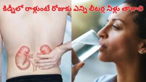 Health Tips: కేవలం వాటర్ తాగితే సరిపోదూ.. కిడ్నీలోని రాళ్లు పోవాలంటే ఇలా చేయాల్సిందే!