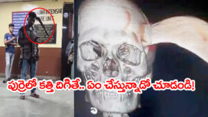 Watch Video: తలలో దిగిన కొడవలితో.. ఫోన్‌ చూసుకుంటూ ఆసుపత్రికి నడిచి వెళ్లిన యువకుడు! ఆ తర్వాత సీన్‌ ఇదే