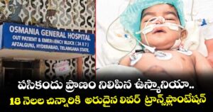 పసికందు ప్రాణం నిలిపిన ఉస్మానియా.. 18 నెలల చిన్నారికి  అరుదైన లివర్  ట్రాన్స్⁭ప్లాంటేషన్