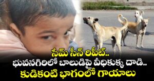 సేమ్ సీన్ రిపీట్.. భువనగిరిలో బాలుడిపై వీధికుక్క దాడి..కుడికంటి భాగంలో గాయాలు