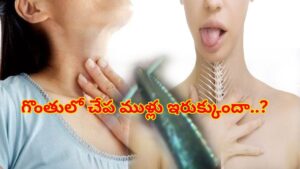చేపలు తింటున్నారా జాగ్రత్త! గొంతులో ముల్లు ఇరుక్కుందని కంగారు పడకండి.. ఈ సులువైన చిట్కాలతో ఈజీగా బయటపడండి!