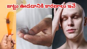 జుట్టు కుచ్చులు కుచ్చులుగా ఊడిపోవడానికి అసలు కారణాలు ఇవే.. ఇలా చేస్తే మీ వెంట్రుకలు సేఫ్..