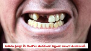 Dental Care: వృద్ధాప్యంలో దంతాలు ఎందుకు ఊడిపోతాయో తెలుసా? వైద్యులు చెబుతున్న అసలు కారణాలు ఇవే!