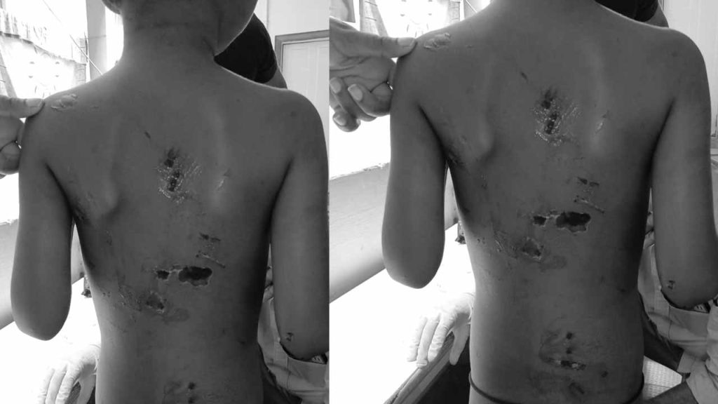 Chittoor Horror: అసలు తల్లివేనా..? వివాహేతర సంబంధానికి అడ్డుగా ఉన్నాడని ఏడేళ్ల కుమారుడికి చిత్రహింసలు..!