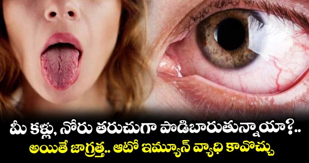 మీ కళ్లు, నోరు తరుచుగా పొడిబారుతున్నాయా?.. అయితే జాగ్రత్త.. ఆటో ఇమ్యూన్ వ్యాధి కావొచ్చు