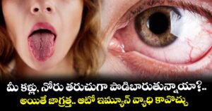 మీ కళ్లు, నోరు తరుచుగా పొడిబారుతున్నాయా?.. అయితే జాగ్రత్త.. ఆటో ఇమ్యూన్ వ్యాధి కావొచ్చు