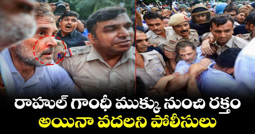 రాహుల్ గాంధీ ముక్కు నుంచి రక్తం.. అయినా వదలని పోలీసులు
