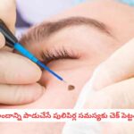 Skin Warts: రూపాయి ఖర్చు లేకుండా పులిపిర్లను రాల్చేసే చిట్కాలు.. మీ అందాన్ని పాడుచేసే ఆ సమస్యకు చెక్